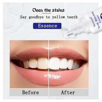 Beljenje zob Bistvo Ustno Higieno Čiščenje, Serum, Odstranjevanje zobnih Oblog Madežev Zob Beljenje Tekoče Zobni 10 ML Ustno Nego 101839