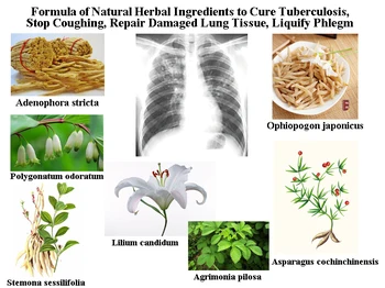 Formula Naravnih Sestavin rastlinskega izvora za Zdravljenje Tuberkuloze, Stop Kašelj, Popravilo Poškodovanih Pljučnega Tkiva, Liquify Flegma