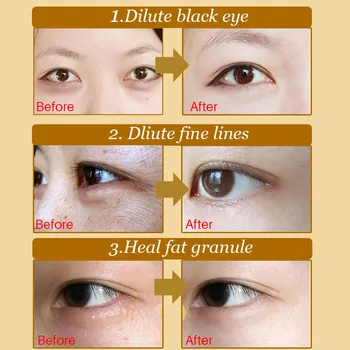 BOLUOYIN 20Pcs Kristalno Kolagena Zlato Oči Masko Anti-Aging podočnjake Akne Lepotnih Popravkov Za Oči Nego Kože korejski Kozmetika 17408