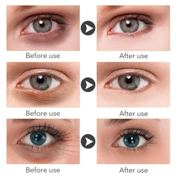 2Pcs 30 g Eye Care Krema Za Lajšanje Oči, Utrujenost, Izboljša Vid Kitajski Zeliščni Medicini za Nego Oči Zdravje Izdelke D3219 18133