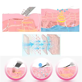 Ultrazvočno Kože Scruber Globinsko Čiščenje Obraza Scruber Opozarjanje Z Obraza Čiščenje Kože Lopatico Peeling Lepoto Instrument Naprave